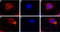 Transient Receptor Potential Cation Channel Subfamily V Member 4 antibody, GTX54764, GeneTex, Immunocytochemistry image 