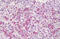 Colony Stimulating Factor 2 Receptor Beta Common Subunit antibody, MBS247912, MyBioSource, Immunohistochemistry paraffin image 