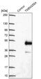 Transmembrane Protein 255A antibody, PA5-61745, Invitrogen Antibodies, Western Blot image 