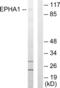 EPH Receptor A1 antibody, abx013430, Abbexa, Western Blot image 