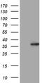 Tubulin Epsilon And Delta Complex 1 antibody, TA811443, Origene, Western Blot image 