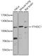 YTH Domain Containing 1 antibody, A06172, Boster Biological Technology, Western Blot image 