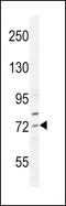 Sterol Regulatory Element Binding Transcription Factor 2 antibody, PA5-24167, Invitrogen Antibodies, Western Blot image 