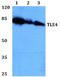 TLE Family Member 4, Transcriptional Corepressor antibody, A04314, Boster Biological Technology, Western Blot image 