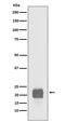 Teratocarcinoma-Derived Growth Factor 1 antibody, M03105-1, Boster Biological Technology, Western Blot image 