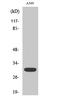 Siah E3 Ubiquitin Protein Ligase 1 antibody, A02095, Boster Biological Technology, Western Blot image 