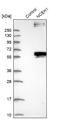 Neutral cholesterol ester hydrolase 1 antibody, NBP1-90294, Novus Biologicals, Western Blot image 