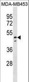 NADH:Ubiquinone Oxidoreductase Core Subunit V1 antibody, LS-B9338, Lifespan Biosciences, Western Blot image 