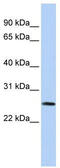 Vestigial Like Family Member 1 antibody, TA344479, Origene, Western Blot image 