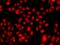 TEA Domain Transcription Factor 3 antibody, GTX32917, GeneTex, Immunocytochemistry image 