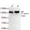 Tripartite Motif Containing 33 antibody, TA347063, Origene, Western Blot image 