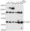 Cholecystokinin B Receptor antibody, LS-C749569, Lifespan Biosciences, Western Blot image 