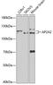 Adaptor Related Protein Complex 2 Subunit Alpha 2 antibody, GTX30051, GeneTex, Western Blot image 