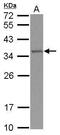 TRNA Methyltransferase 61A antibody, PA5-31452, Invitrogen Antibodies, Western Blot image 