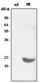 Crystallin Alpha B antibody, LS-C93714, Lifespan Biosciences, Western Blot image 