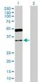 Glyoxylate And Hydroxypyruvate Reductase antibody, H00009380-D01P, Novus Biologicals, Western Blot image 