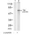 Protein Kinase D1 antibody, GTX78966, GeneTex, Western Blot image 