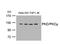 Protein Kinase D1 antibody, GTX50472, GeneTex, Western Blot image 