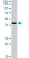 Putative gonadotropin-releasing hormone II receptor antibody, H00114814-M01, Novus Biologicals, Western Blot image 