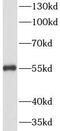 Vimentin antibody, FNab09409, FineTest, Western Blot image 