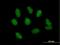 NSE1 Homolog, SMC5-SMC6 Complex Component antibody, H00197370-B01P, Novus Biologicals, Immunocytochemistry image 