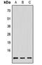 PAGE Family Member 3 antibody, orb256739, Biorbyt, Western Blot image 