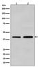 Actin Alpha 2, Smooth Muscle antibody, M01072-1, Boster Biological Technology, Western Blot image 