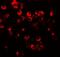 C-X-C Motif Chemokine Receptor 3 antibody, GTX31566, GeneTex, Immunofluorescence image 