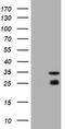 O-6-Methylguanine-DNA Methyltransferase antibody, LS-C789030, Lifespan Biosciences, Western Blot image 