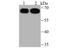 Ubiquitin Specific Peptidase 22 antibody, NBP2-75702, Novus Biologicals, Western Blot image 