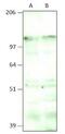 Aquarius Intron-Binding Spliceosomal Factor antibody, GTX47914, GeneTex, Western Blot image 