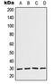 COP9 Signalosome Subunit 7A antibody, orb215162, Biorbyt, Western Blot image 