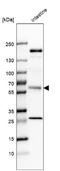 B7-H7 antibody, NBP2-49187, Novus Biologicals, Western Blot image 