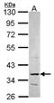 Phosphoribosyl Pyrophosphate Synthetase 2 antibody, orb69905, Biorbyt, Western Blot image 
