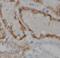 Membrane Metalloendopeptidase antibody, FNab05230, FineTest, Immunohistochemistry paraffin image 