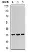 Fibroblast Growth Factor 18 antibody, orb339102, Biorbyt, Western Blot image 