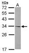 Alport Syndrome, Mental Retardation, Midface Hypoplasia And Elliptocytosis Chromosomal Region Gene 1 antibody, NBP2-15377, Novus Biologicals, Western Blot image 