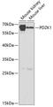 PDZ Domain Containing 1 antibody, A03176, Boster Biological Technology, Western Blot image 