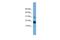 Interleukin 36 Receptor Antagonist antibody, PA5-44387, Invitrogen Antibodies, Western Blot image 