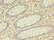 Butyrophilin Subfamily 3 Member A1 antibody, LS-C375315, Lifespan Biosciences, Immunohistochemistry paraffin image 