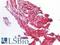 Receptor Tyrosine Kinase Like Orphan Receptor 1 antibody, LS-A12071, Lifespan Biosciences, Immunohistochemistry paraffin image 