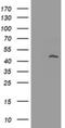 MAGE Family Member A3 antibody, NBP2-45719, Novus Biologicals, Western Blot image 