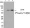 Spleen Associated Tyrosine Kinase antibody, PA5-37747, Invitrogen Antibodies, Western Blot image 