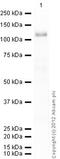 Component Of Inhibitor Of Nuclear Factor Kappa B Kinase Complex antibody, ab32041, Abcam, Western Blot image 