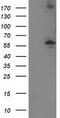 Protein Phosphatase, Mg2+/Mn2+ Dependent 1B antibody, CF502863, Origene, Western Blot image 