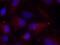 P21 (RAC1) Activated Kinase 1 antibody, GTX38587, GeneTex, Immunofluorescence image 