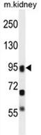 Arachidonate Lipoxygenase 3 antibody, AP50154PU-N, Origene, Western Blot image 