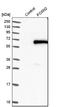 Forkhead Box N2 antibody, NBP1-83153, Novus Biologicals, Western Blot image 