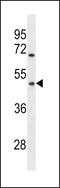 Olfactory Receptor Family 1 Subfamily Q Member 1 antibody, LS-C158457, Lifespan Biosciences, Western Blot image 