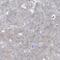 TRNA Methyltransferase 2 Homolog B antibody, NBP1-85370, Novus Biologicals, Immunohistochemistry paraffin image 